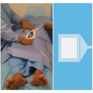 PCNL Drape