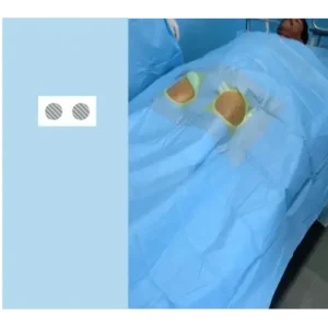 Angioplasty Drape